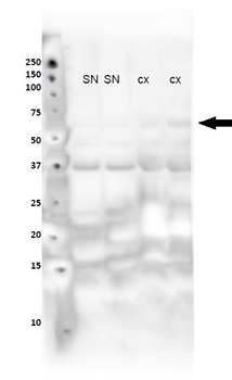 NR4A2 Rabbit Polyclonal Antibody