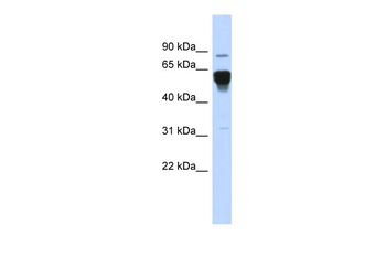 NR4A2 Rabbit Polyclonal Antibody