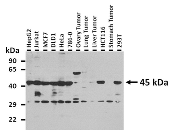 TARDBP Rabbit Polyclonal Antibody