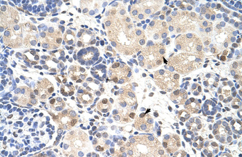 TARDBP Rabbit Polyclonal Antibody