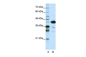 TARDBP Rabbit Polyclonal Antibody