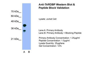 TARDBP Rabbit Polyclonal Antibody