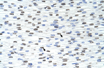 TARDBP Rabbit Polyclonal Antibody