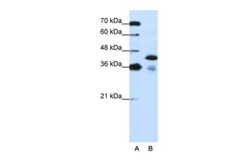 TARDBP Rabbit Polyclonal Antibody