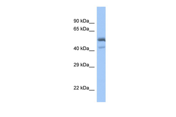 SPDEF Rabbit Polyclonal Antibody