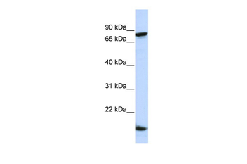 ZNF281 Rabbit Polyclonal Antibody