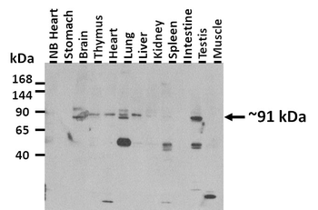 PPARGC1A Rabbit Polyclonal Antibody