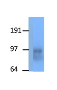 PPARGC1A Rabbit Polyclonal Antibody