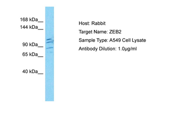 ZEB2 Rabbit Polyclonal Antibody