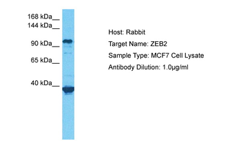 ZEB2 Rabbit Polyclonal Antibody