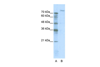 ZHX2 Rabbit Polyclonal Antibody