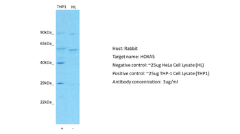 HOXA5 Rabbit Polyclonal Antibody