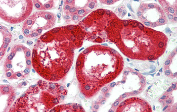 SOX17 Rabbit Polyclonal Antibody