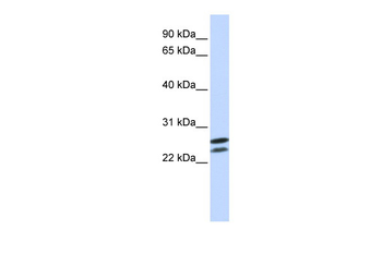 HOXB4 Rabbit Polyclonal Antibody