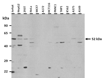 BCL6B Rabbit Polyclonal Antibody