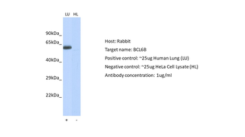BCL6B Rabbit Polyclonal Antibody