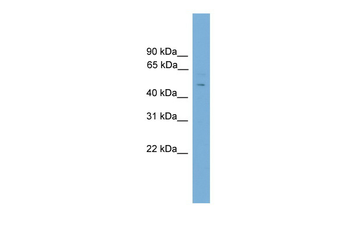 Foxc2 Rabbit Polyclonal Antibody
