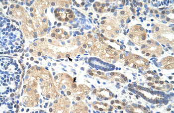 PRMT5 Rabbit Polyclonal Antibody