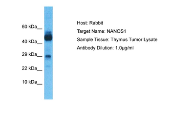 NANOS1 Rabbit Polyclonal Antibody