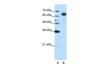 FXR1 Rabbit Polyclonal Antibody