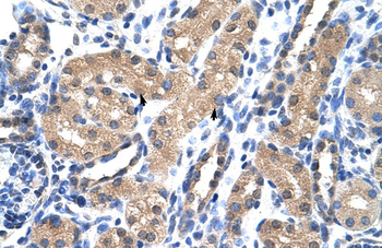 RAE1 Rabbit Polyclonal Antibody