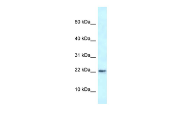Rbm3 Rabbit Polyclonal Antibody