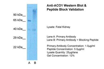 ACO1 Rabbit Polyclonal Antibody