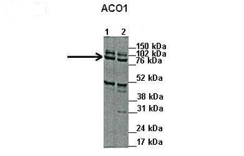 ACO1 Rabbit Polyclonal Antibody