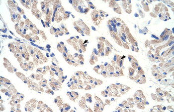 ACO1 Rabbit Polyclonal Antibody