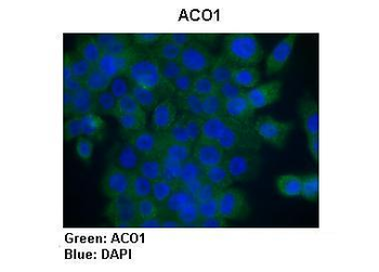 ACO1 Rabbit Polyclonal Antibody