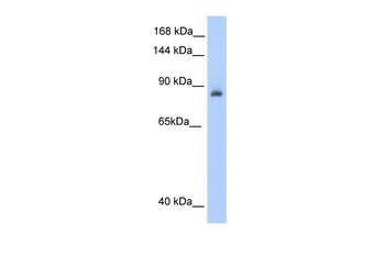 ACO1 Rabbit Polyclonal Antibody