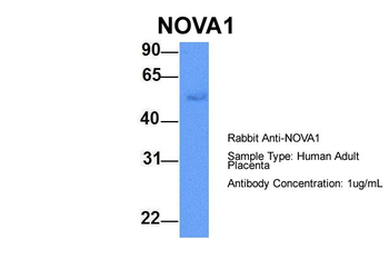 NOVA1 Rabbit Polyclonal Antibody
