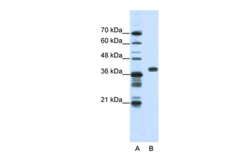 PCBP1 Rabbit Polyclonal Antibody