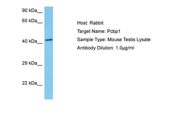 PCBP1 Rabbit Polyclonal Antibody