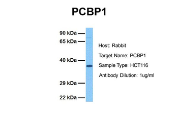 PCBP1 Rabbit Polyclonal Antibody