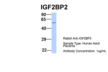 IGF2BP2 Rabbit Polyclonal Antibody