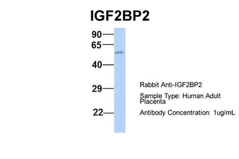 IGF2BP2 Rabbit Polyclonal Antibody
