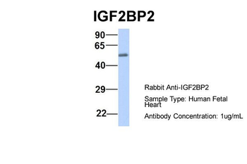 IGF2BP2 Rabbit Polyclonal Antibody
