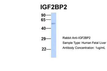 IGF2BP2 Rabbit Polyclonal Antibody