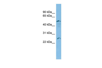 APOBEC2 Rabbit Polyclonal Antibody