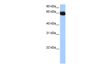 NSUN6 Rabbit Polyclonal Antibody
