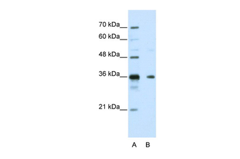 NANOS1 Rabbit Polyclonal Antibody