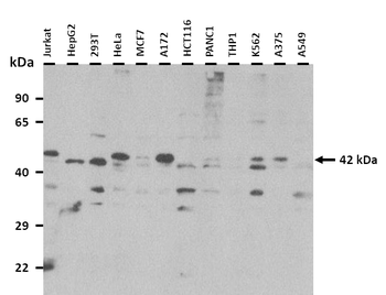 MBNL1 Rabbit Polyclonal Antibody