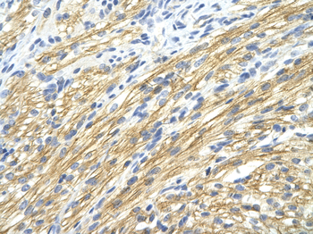 MBNL1 Rabbit Polyclonal Antibody