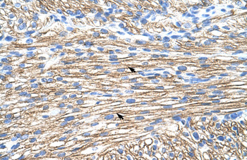 MBNL1 Rabbit Polyclonal Antibody