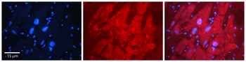 MBNL1 Rabbit Polyclonal Antibody