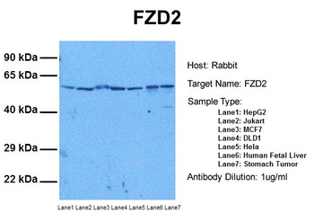 FZD2 Rabbit Polyclonal Antibody