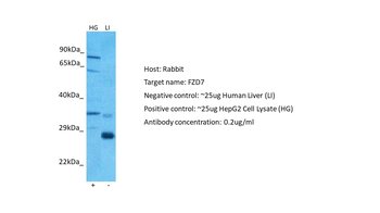 FZD7 Rabbit Polyclonal Antibody