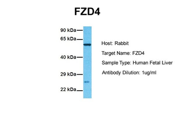 FZD4 Rabbit Polyclonal Antibody
