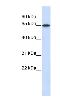 FZD4 Rabbit Polyclonal Antibody